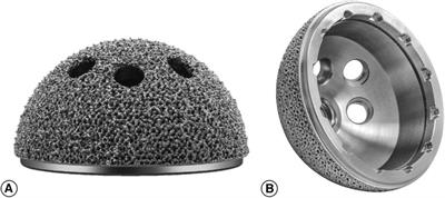 A prospective and consecutive study assessing short-term clinical and radiographic outcomes of Chinese domestically manufactured 3D printing trabecular titanium acetabular cup for primary total hip arthroplasty: evaluation of 236 cases